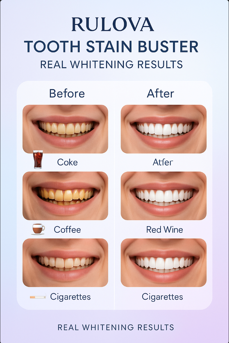 Rulova Whitening Toothpaste Rulova